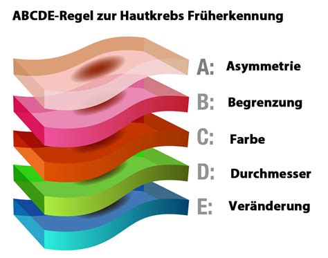 Hautkrebs erkennen Die 5 typischen Symptome & Anzeichen