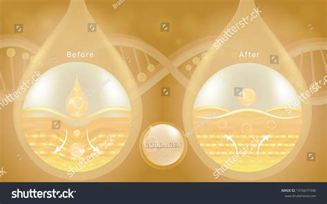 Hyaluronic Acid Before After Skin Solutions Stock Vector (Royalty Free ...