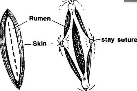 Rumenotomy