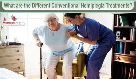 What are different hemiplegia types and its treatment?