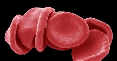 7 Rare Diseases That Affect the Blood | Healthgrades.com