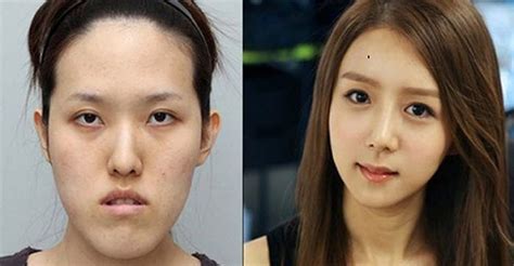 Why is Plastic Surgery so Popular in South Korea? | by ClinicCoKr | Medium