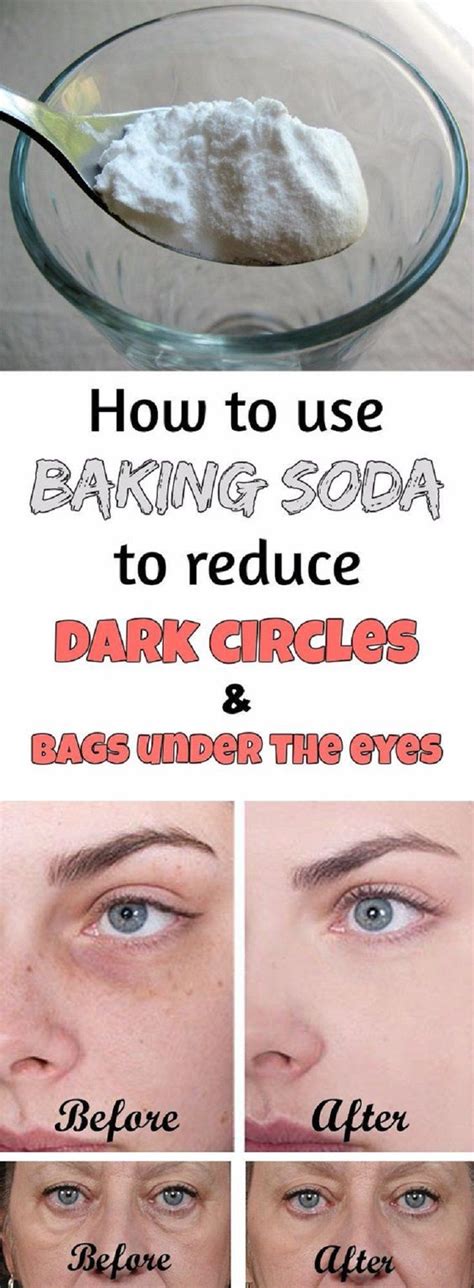 Bags Dark Circles Under Eyes Treatment - cover page graphics