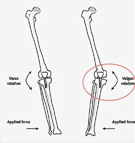 Camden Depot: A Brief Overview of Manny Machado's Knee Injury