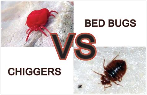 Chiggers Vs Bed Bugs - In 10 Important Points Explained! | Y-L-P-C