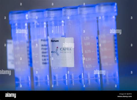 preparation of blood serum Stock Photo - Alamy