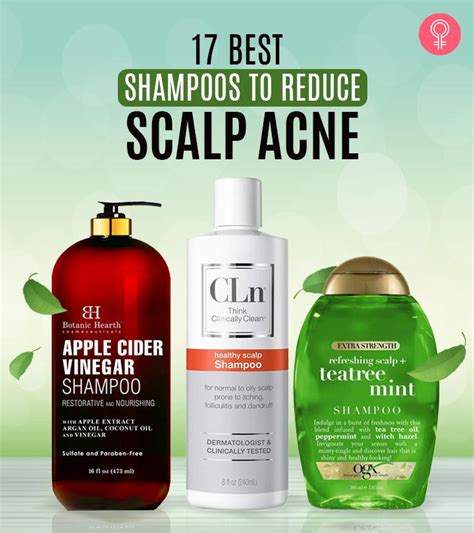 These Are The 17 Best Scalp Acne Shampoos To Try In 2023