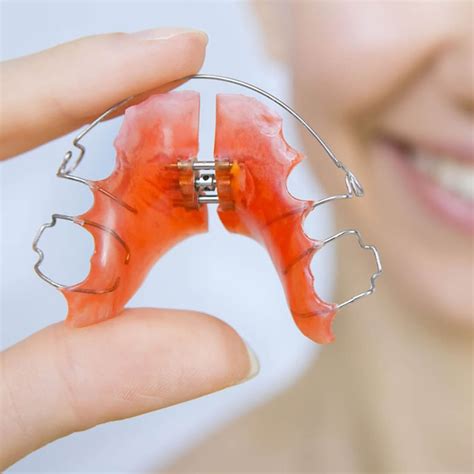 Retainers | Orthodontist In Edinburgh | NHS & Clear Braces