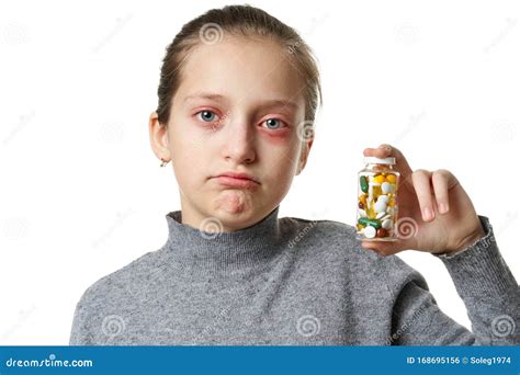 Allergic Reaction, Skin Rash, Close View Portrait of a Girl`s Face ...