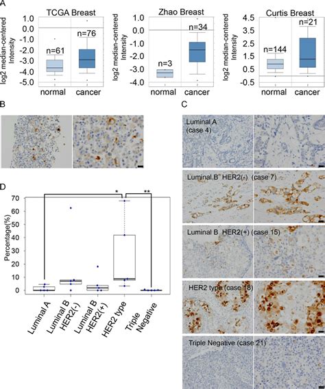 Expression levels of GDF15 are heterogeneous among cancer cells in MCF7... | Download Scientific ...