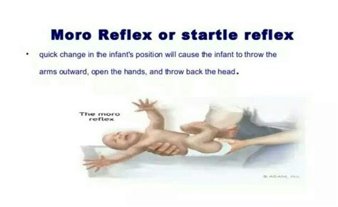 MORO reflex | Moro reflex, Medical ultrasound, Developmental psychology