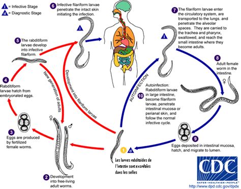 Estrongiloidiasis; Anguilulosis