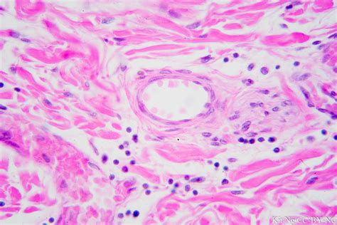 Simple Squamous Epithelium – Kit Ng, Ph.D.