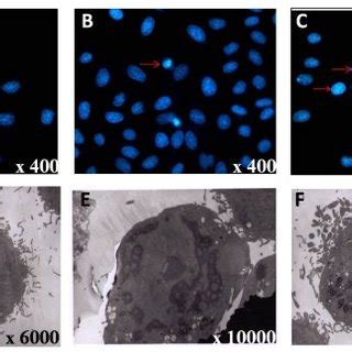 Chromatin condensation and nuclear fragmentation typical for apoptosis ...