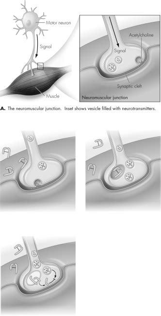 This Figure Shows the Mechanism of Action of Botulinum Toxin | Biology+