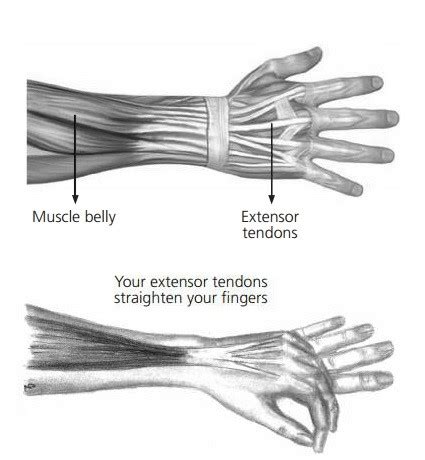 Hand Therapy - Extensor Tendon Finger Repair (Merritt) - North Tees and ...