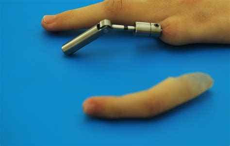 Finger prosthesis for amputee