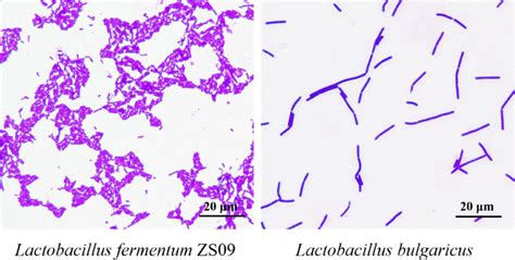 Lactobacillus Gram Stain