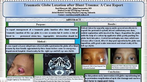 Traumatic Globe Luxation after Blunt Trauma A Case