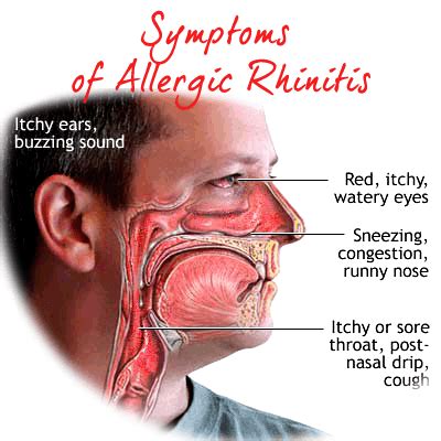 Spring Allergic Rhinitis: Symptoms and Treatments - AirTamer