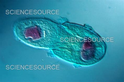 Didinium Under Microscope