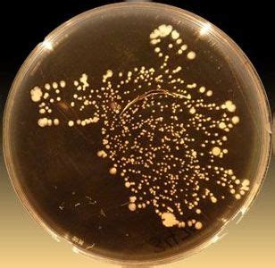 Multiple new strains of bacteria discovered in the human belly button