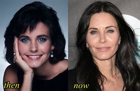 Courteney Cox Before And After Face Reconstruction