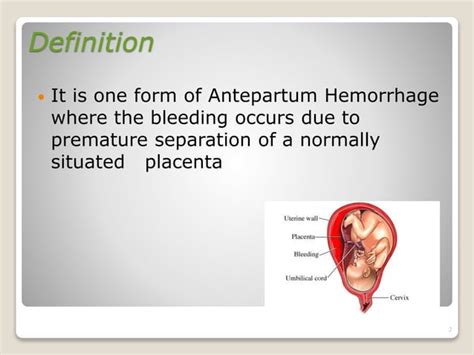 Abruptio placenta- Define, cause, sign and symptoms, Risk Factors, Incidence,pathology ...