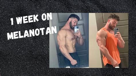 1 week on melanotan // Side effects? - YouTube