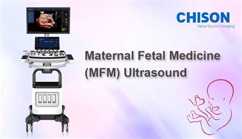 What Is Maternal Fetal Medicine (MFM) Ultrasound?