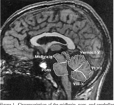 [PDF] A quantitative MRI study of posterior fossa development in ...