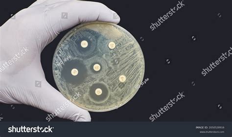 61 Antibiogram Images, Stock Photos, 3D objects, & Vectors | Shutterstock