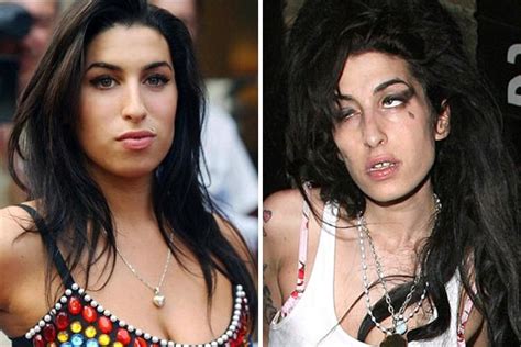 Horrible: 18 Shocking Photos Of Famous Celebrities Before And After Drugs Addiction - GhPage