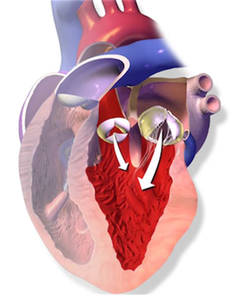 Aortic Semilunar Valve | Location, Structure & Function - Lesson ...