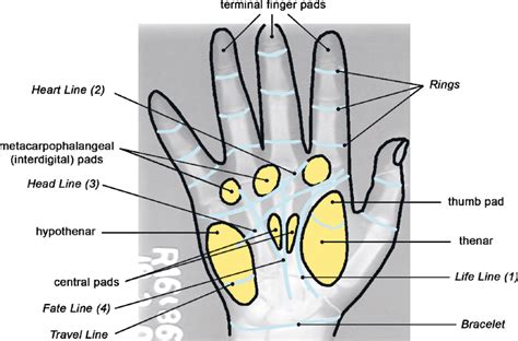 Diagram of palm pads and flexion creases plotted on radiograph of hand... | Download Scientific ...