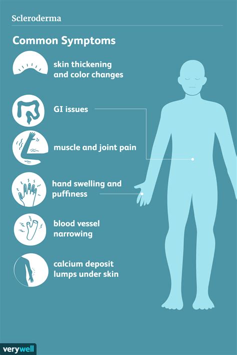 Symptoms of Scleroderma (2023)