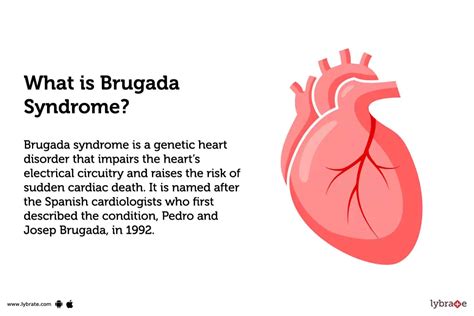 Brugada Syndrome: Treatment, Procedure, Cost, Recovery, Side Effects ...