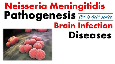 Neisseria meningitidis microbiology | Pathogenesis, lab diagnosis, disease, treatment - YouTube