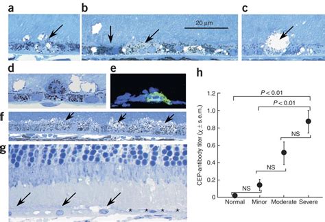 Relationship between pathology and CEP-specific antibody titer in the ...