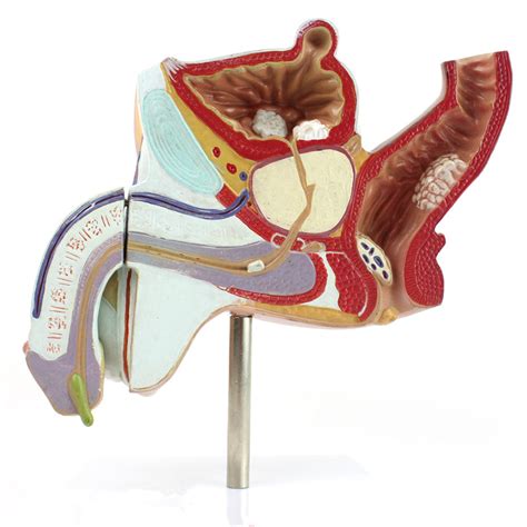 Male Pelvis Cross Section Model with Pathologies GJ302L – AnatomyChina.com