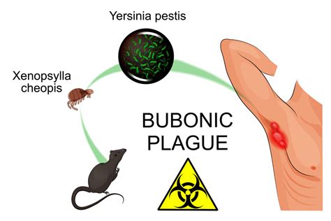 Pathogen of the Month: Yersinia Pestis - GIDEON - Global Infectious Diseases and Epidemiology ...