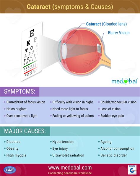 Cataract (Symptoms & Causes) – Medobal – Medium