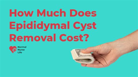 How Much Does Cyst Removal Cost? Get the #1 Best Price