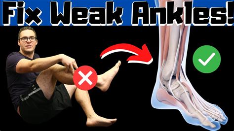 Fix WEAK Ankles [Strengthening Exercises & Sprain Rehab]