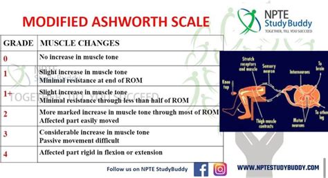 Modified ashworth scale | Physical therapy student, Physical therapy assistant, Physical therapy