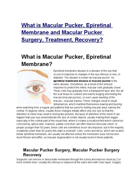 What is Macular Pucker , Epiretinal Membrane and Macular Pucker Surgery ...