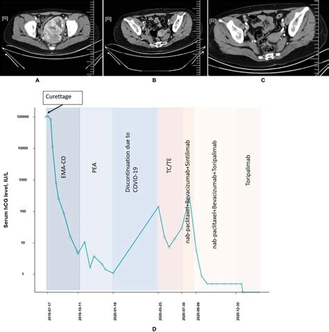 Frontiers | Effectiveness and Safety of Toripalimab Combination Therapies for Patients With ...