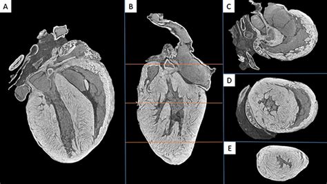 Micro CT Imaging Gallery | School of Dentistry