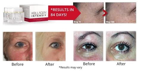 Kollagen Intensiv Before and After – Does It Work, User Reviews!