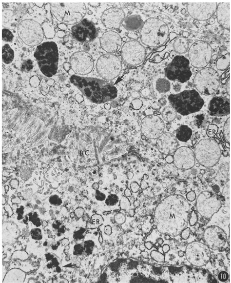 Figure 11 from LIPOFUSCIN (AGING) PIGMENT GRANULES OF THE NEWBORN HUMAN ...